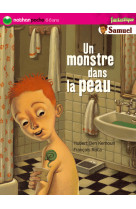 Monstre dans la peau